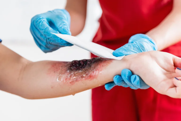 Mislanovich Law - Catastrophic Injury